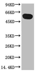 Anti-TUBB1 Monoclonal