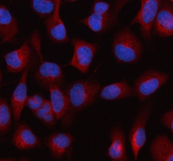 Anti-HDLBP / High density lipoprotein-binding protein / Vigilin
