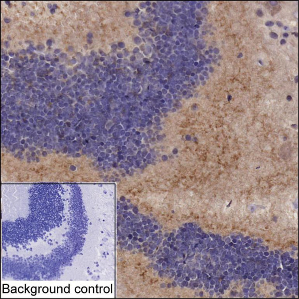 Anti-HCN1