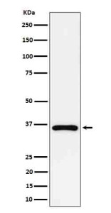 Anti-GAS2 / Growth arrest specific protein 2, clone 31G23