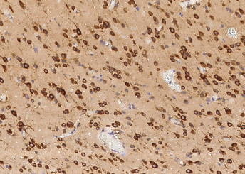 Anti-TLR2 (CD282) Monoclonal Antibody