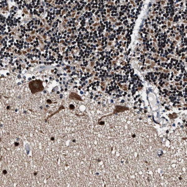 Anti-PRRC2B