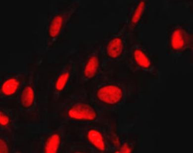 Anti-PPAR gamma