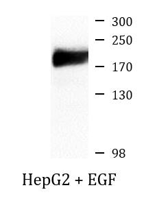 Anti-phospho-CD140a / PDGFRA (Tyr754)