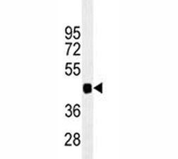 Anti-PAX6, clone 193CT15.2.2