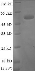 Tissue factor pathway inhibitor (TFPI), partial, human, recombinant