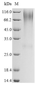 Glucagon receptor (GCGR), partial, human, recombinant