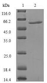 Importin subunit alpha-5 (KPNA1), partial, human, recombinant