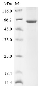 Sphingomyelin phosphodiesterase (SMPD1), human, recombinant