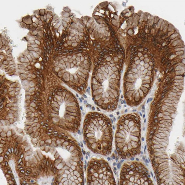 Anti-ASB6