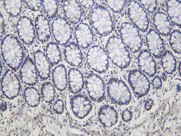 Anti-Recombinant Ku-80, clone C112444