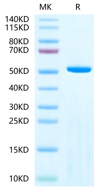 Human Adenylosuccinate Lyase Protein