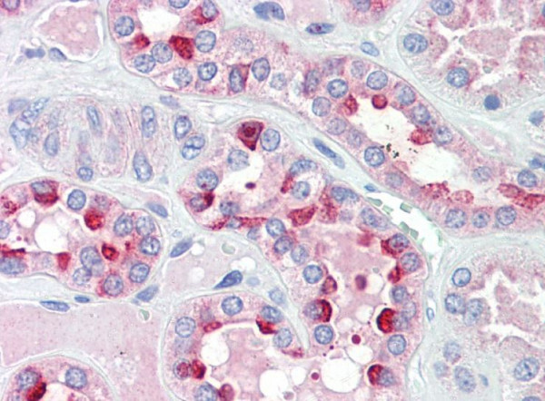 Anti-IDH3G