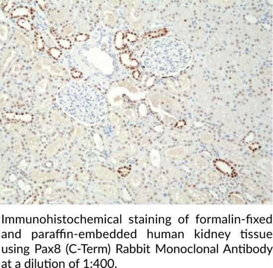 Anti-Pax8 (C-Term) Rabbit Monoclonal Antibody (Clone RM436)