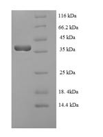 Lytic switch protein BZLF1 (BZLF1), Epstein-Barr virus, recombinant