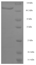 Cytochrome P450 4F11 (CYP4F11), partial, human, recombinant