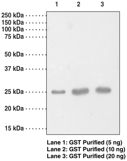 Anti-Glutathione S-Transferase