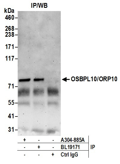 Anti-OSBPL10/ORP10