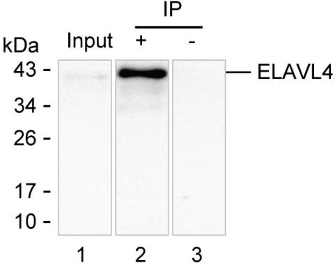 Anti-ELAVL4