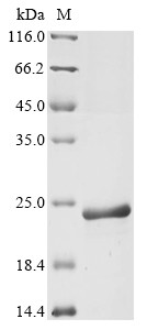 Gag polyprotein (gag), partial, Feline immunodeficiency virus, recombinant
