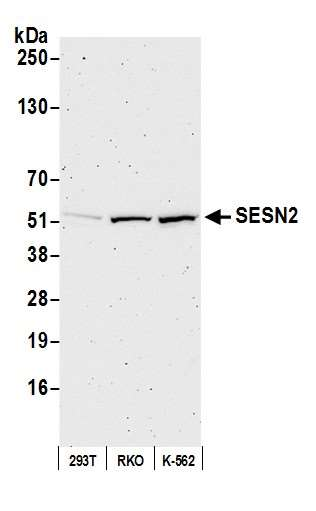 Anti-SESN2