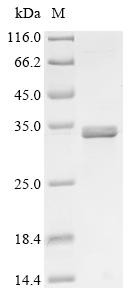 Choline transporter-like protein 4 (SLC44A4), partial, human, recombinant