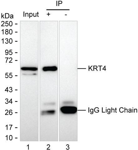 Anti-KRT4