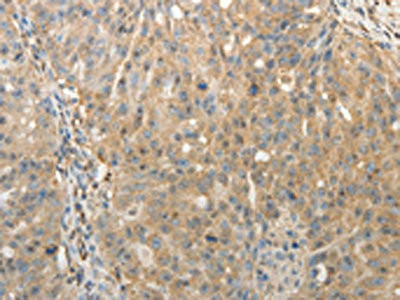 Anti-SULT1E1