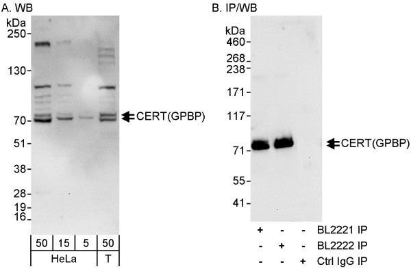 Anti-CERT/GPBP