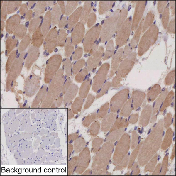 Anti-CDH15
