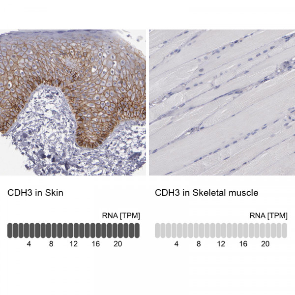 Anti-CDH3