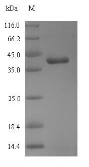 Mitochondrial Rho GTPase 1(RHOT1), partial, chicken, recombinant
