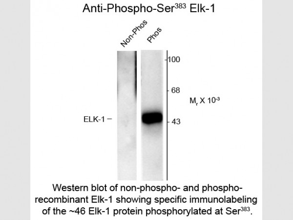 Anti-phospho-Elk-1 (Ser383)
