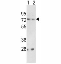 Anti-PCSK2