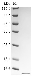 Fragile X mental retardation syndrome-related protein 1 (FXR1), partial, human, recombinant