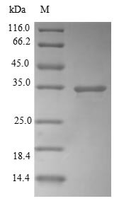 Carbonyl reductase [NADPH] 1 (CBR1), human, recombinant