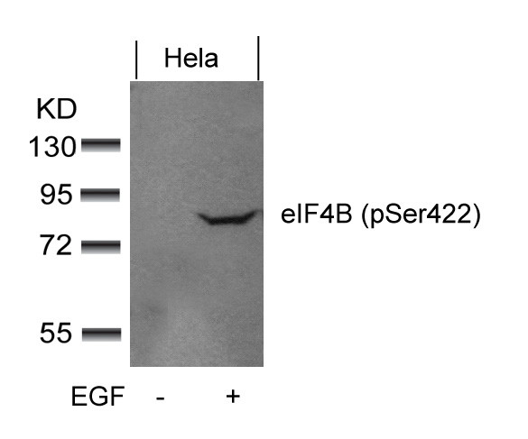 Anti-phospho-eIF4B (Ser422)