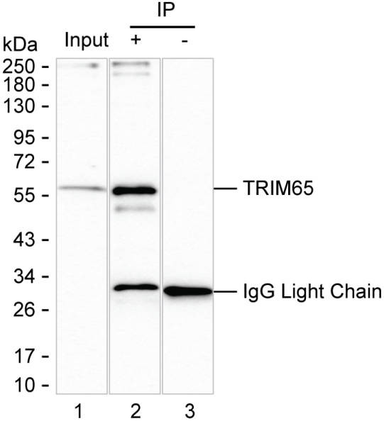 Anti-TRIM65 Magnetic Beads