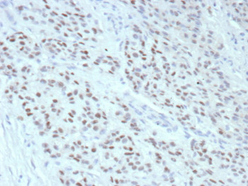 Anti-Estrogen Receptor alpha, clone rESR1/9525