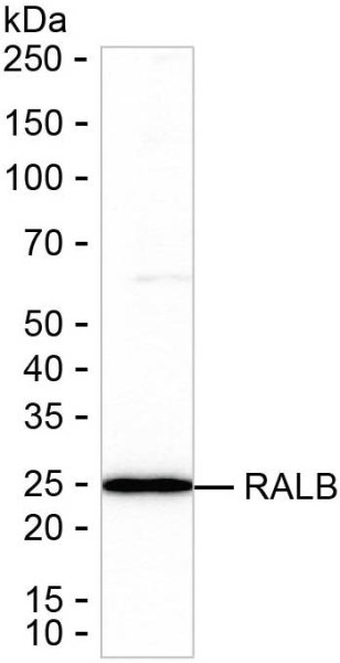 Anti-RALB