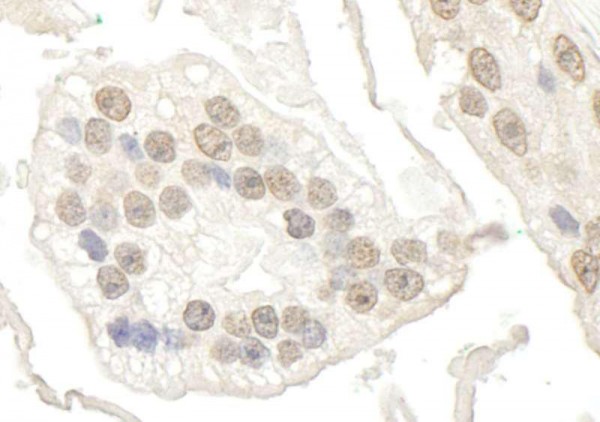 Anti-BRD7 (IHC)