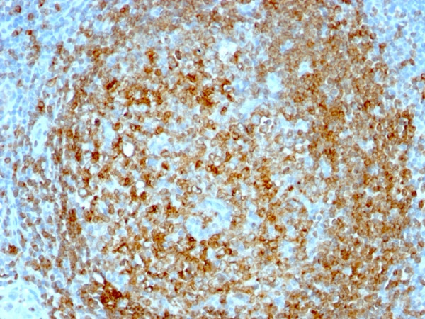 Anti-CD74 (B-Cell Marker), clone CLIP/813