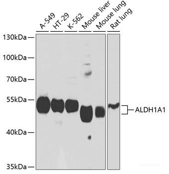 Anti-ALDH1A1