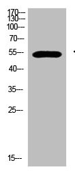 Anti-GCM2
