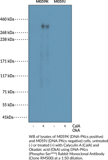 Anti-DNA-PKcs (Phospho-Ser2056) Rabbit (Clone
