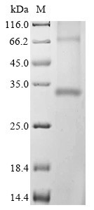 Aquaporin-4 (Aqp4), mouse, recombinant