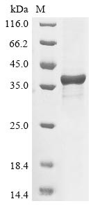 tRNA (guanine-N(7)-)-methyltransferase(Bm1_01445), Brugia malayi, recombinant