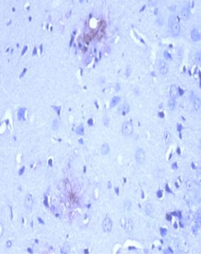 Anti-amyloid beta peptide, clone NT 4A2, N-terminal
