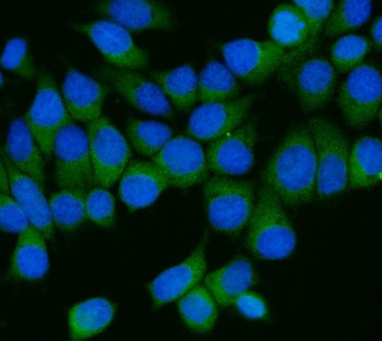 Anti-AP2M1 / AP-2 complex subunit mu