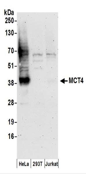 Anti-MCT4